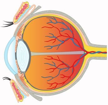 Eléments clés du diagnostic d'une occlusion de la veine centrale ...