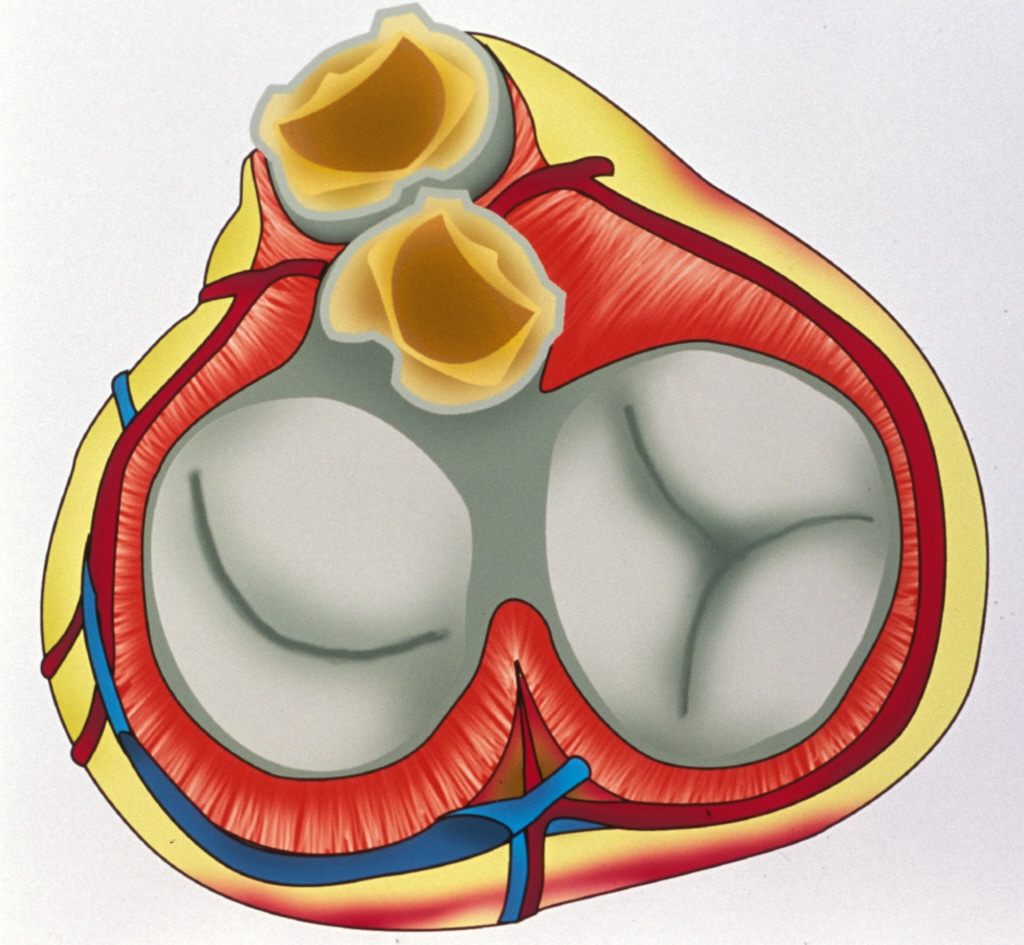 Recommandations de la SEC sur les valvulopathies