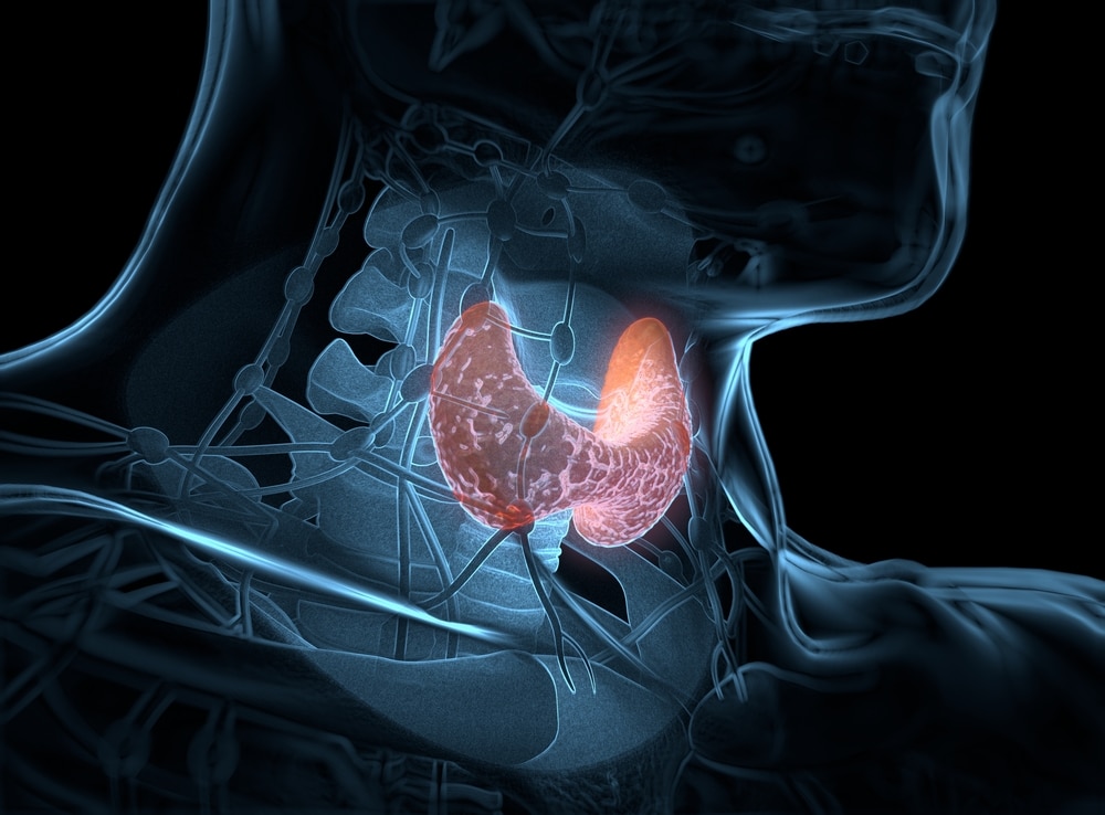 Cœur et hypothyroïdie - Réalités Cardiologiques