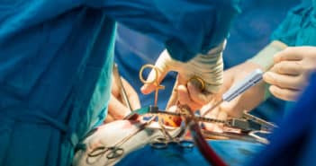La chirurgie de remplacement valvulaire aortique à l’ère du TAVI : pour qui, comment ?