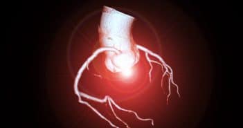 Évaluation de l’ischémie myocardique