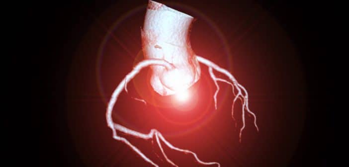 Ischémie myocardique