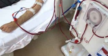 L’hypertension artérielle du patient hémodialysé